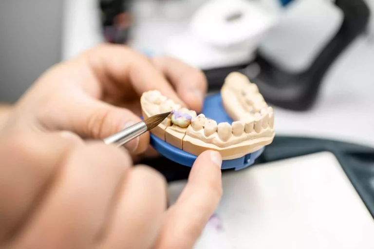 Come cresce un laboratorio odontotecnico