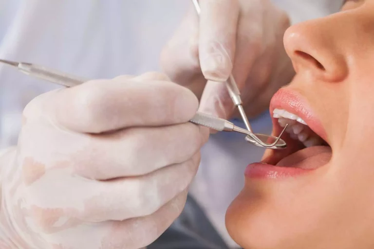 Come trovare il dente giusto al momento giusto